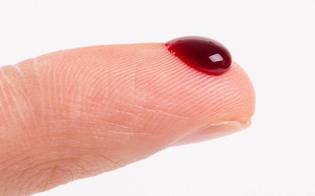 Chiêm bao thấy máu: Gi8 tổng hợp các trường gặp hay gặp