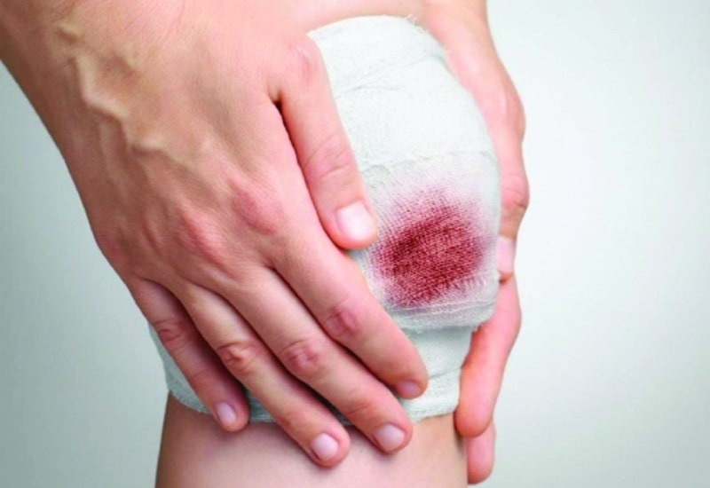 Nằm mơ thấy máu đánh số mấy? Bí kíp sổ mơ chuẩn xác 2025