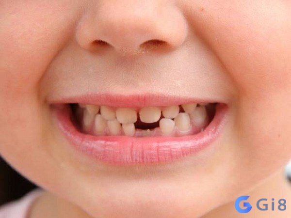 Mơ rụng răng mà không đau đánh ngay: 47 – 51