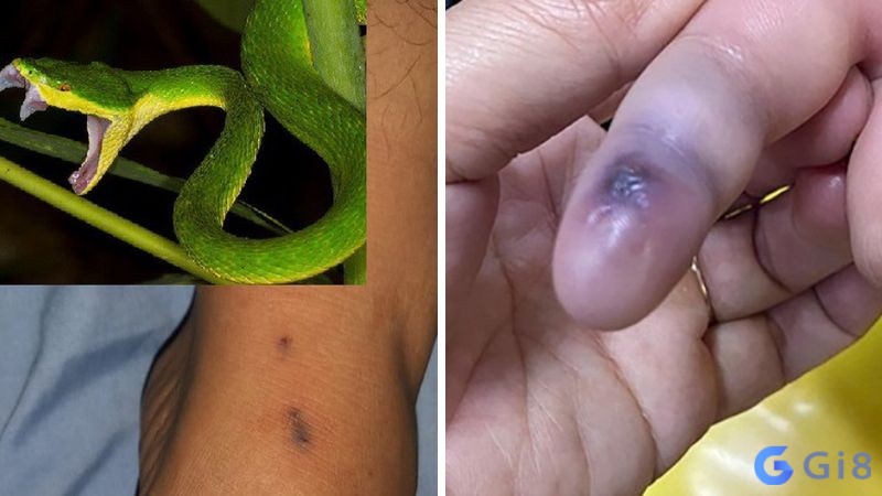 Chiêm bao thấy rắn lục cắn đánh ngay số 93, 39 Chiêm bao thấy rắn lục cắn đánh ngay số 93, 39