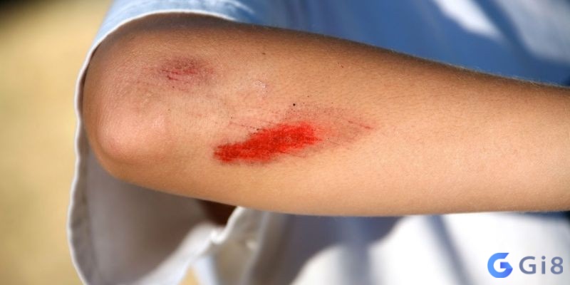 Nằm mơ thấy bị đánh chảy máu là dấu hiệu bị tổn thương tâm hồn hoặc điềm báo hao tài