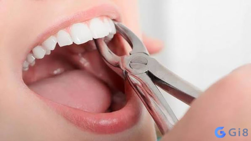 Nằm mơ thấy gãy răng thể hiện cho sự biến động hay thay đổi trong một lĩnh vực nào đó của cuộc sống