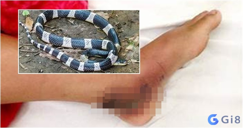 Mơ thấy rắn đen trắng cắn mình thể hiện cho các vấn đề mà bạn đang gặp phải