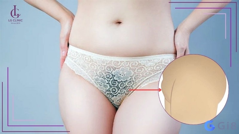 Mơ thấy bướm phụ nữ có nhiều lông thể hiện cho những điều bất ngờ mà bạn gặp phải